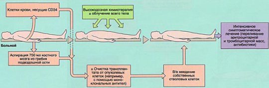 Типы лечебных клизм схема