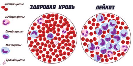 Клетки крови фото с названиями