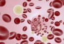 Почему понижаются тромбоциты в крови