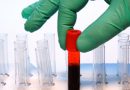 Исследование лейкоцитов WBC в анализе крови