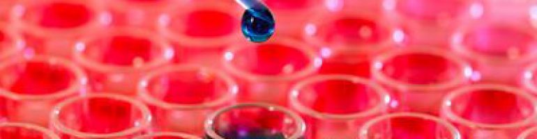 Повышенное количество лейкоцитов в крови