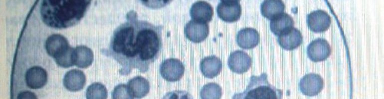 Роль сегментоядерных нейтрофилов в крови