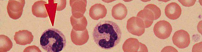 Что означают нейтрофилы в анализе крови