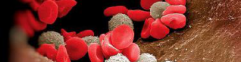 Опасен ли лейкоцитоз крови