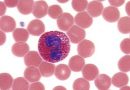 Что обозначают незрелые гранулоциты в крови