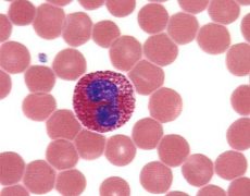 Что обозначают незрелые гранулоциты в крови