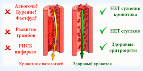 Трава для стула разжижения