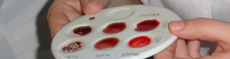 Как определяют группу крови