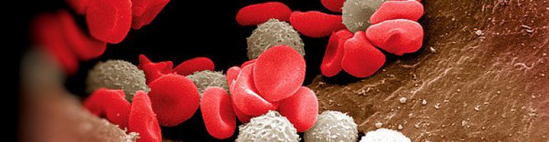 Причины высокого уровня лейкоцитов в крови