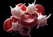 Почему лейкоциты в крови понижаются