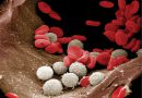 Причины снижения лейкоцитов в крови