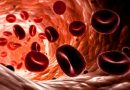 Средний уровень гемоглобина в эритроците (МСНС)