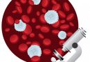 Как поднять количество лейкоцитов в крови