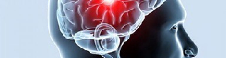 Что такое лейкоареоз головного мозга