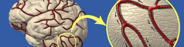 Как очистить сосуды головного мозга