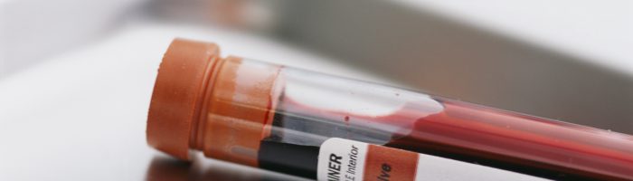 Как расшифровывается анализ крови на RW