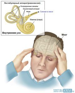Головокружение на фоне невроза
