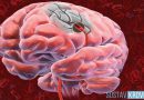 Мозговые и внемозговые опухоли мозга
