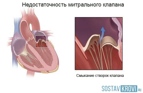 Расположение клапанов сердца