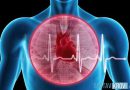 Синдром ранней реполяризации желудочков сердца